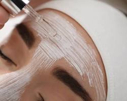 Imagem de Peelings, um procedimento da beleza full face