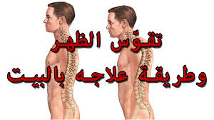 علاج تقوس الظهر تقوس الظهر اسبابه وعلاجه ابداع افكار