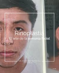 Una rinoplastia de excelencia es una obra de personalización. Se aleja de  las tendencias y se centra en la anatomía única de cada paciente. En la  consulta de valoración, no solo escucho