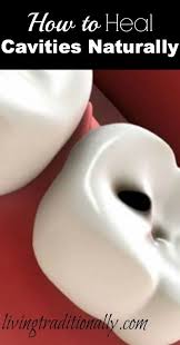 How To Heal Cavities Naturally Heal Cavities Teeth Health Health