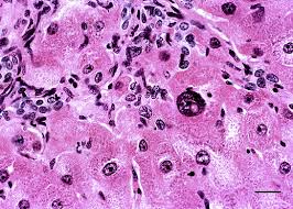 Image result for Crotalaria laburnoides