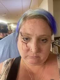 WWE Hall of Famer Ted DiBiase Suffers Fall At Airport; Black Eye & Bruised  Ribs Ted DiBiase recently went