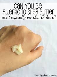 However, the swelling can persist for some time, until the reaction of the bleach on your scalp subsides, and slowly heals. Allergic Reactions To Shea Butter Used On Skin Hair Can They Happen Beautymunsta Free Natural Beauty Hacks And More