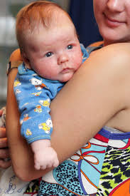 Introducing dairy to milk allergy infant. Milk Allergy In Babies Breastfeeding Support
