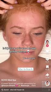 Harper Zilmer Skin Care