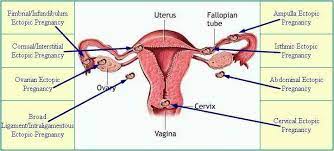 Lymph nodes groin area females. Ag 5477 Groin Diagram Female Download Diagram