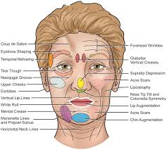 The symptoms of inadequate ventilation are: Injection Technique In Neurotoxins And Fillers Indications Products And Outcomes Journal Of The American Academy Of Dermatology