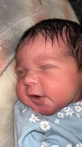 Callouses in cellist fingers: causes and solutions