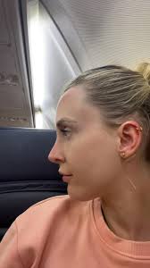 Anyone travel to Antalya Turkey instead of Istanbul? Most of the surgeons  I've researched are in Istanbul but one I'm seriously considering is in  Antalya. Can anyone share their experience? I'm coming