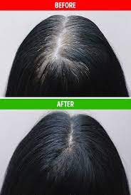 Dec 06, 2020 · method 2. 10 Beauty Problems That Castor Oil Can Help You Solve