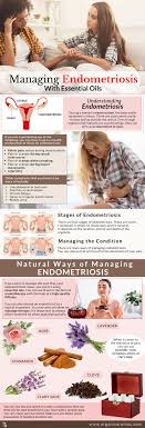 Learn how and why cystic acne cystic acne can affect anyone. Managing Endometriosis With Essential Oils Organic Aromas