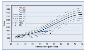 Estimation Poids Naissance Anna Lambert
