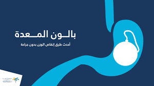 تفاصيل عملية بالون المعدة للتخسيس 2020 الأسعار النظام الغذائي