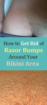 How To Get Rid Of Razor Bumps Around Your Bikini Area In 2020 Shaving Bikini Area Bikini Shaving Bikini Area