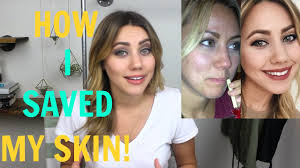 Oil makes your hair retain moisture for longer when you wash week in week out with a regular shampoo, you are stripping oil and moisture from your hair, which is why it becomes so dry and brittle. How I Beat My Acne Oil Cleansing Method Youtube