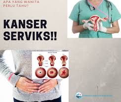 Serviks kanserinin ilk başlangıç evrelerinde genellikle hiçbir belirti ve bulgu görülmez. Farmasi Ammar Medicare Kanser Serviks Apa Yang Wanita Perlu Tahu Apakah Serviks Serviks Adalah Otot Yang Menghubungkan Rahim Wanita Dengan Farajnya La Membentuk Pembukaan Yang Membolehkan Laluan Darah Haid Dan Bayi Apakah