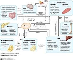 Image result for Cachexia in Cancer