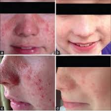 Letter to the Editor