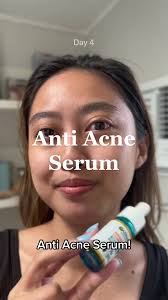 HONEST REVIEW TIME! 👀 See my full journey