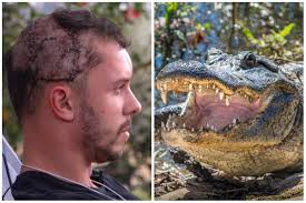 Take Mating Season Seriously' Says Florida Man Who Was Bitten by Alligator 