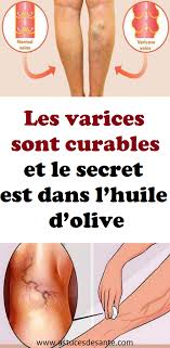 Pin On Sante