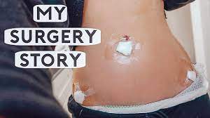 My Surgery Story Endometriosis Youtube