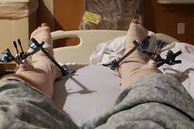 Fundraiser for Hattie Schwartz by jason hamman : Help Jason With Medical  Expenses