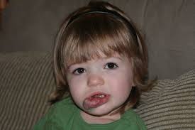 Demonizing Differences. There was a time when birthmarks were…