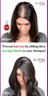 The possible causes of thinning hair can be pregnancy, stress and anxiety, an excess of vitamin a, lack of protein, anaemia, thyroid, autoimmune disorders, weight loss or chemical treatments on your hair. Thinning Hair As Well As Bald Patches Are Remarkably Typical In Ladies See The Develop In 2021 Natural Hair Loss Hair Loss Women Treatment Hair Loss Treatment Shampoo