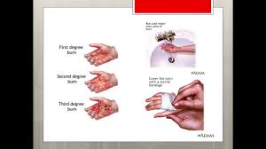 Remember, first aid is not medical treatment, but rather the basic first aid understanding you need to help someone who has been injured in the workplace. First Aid Training 2018 Youtube