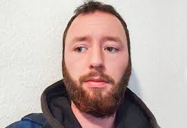 Felix V: before after pictures