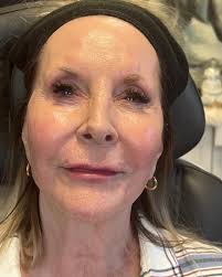 One of the things I am most passionate about is helping women age  gracefully… Helping women look their best even into their 70s and 80s… This  lovely lady has trusted me with