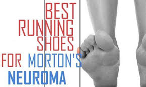 Pin On Morton S Nueroma