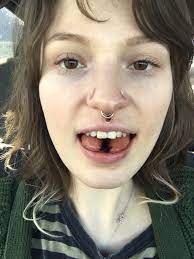 I Took The Plunge Of Getting My Tongue Split Today Bodymods