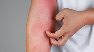 नींद में मुंह से लार टपकने के 5 गंभीर कारण, तुरंत Doctor से कराएं जांच

HEALTH  NEWS 5 serious reasons for drooling during sleep, get checked by a doctor immediately