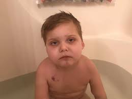 Amy said Gage is done for the day. He has 5 therapy sessions starting at 8  this morning. According to her has been hectic all day . Just enough time  to get