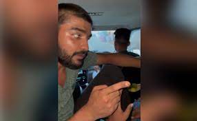 Madhya Pradesh Man Brutally Thrashed, Forced To Lick Feet In Moving Car