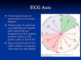 Practical Electrocardiography Qrs Axis Determination Ppt Download