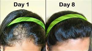 List of home remedies to increase hair volume naturally. How To Make Hair Thick Strong Naturally At Home K4 Fashion