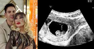 1 day ago · estoy muy contenta de anunciarles que tengo tres meses de embarazo y marcos d1 está muy contento que será papá, fueron las palabras que escribió la vedette mexicana, lyn may, en su cuenta de instagram, lo que ha sorprendido al mundo por una noticia tan relevante a la edad de la actriz. Ownkr0hixqxaom