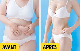 On A Beau Avoir Plannifie Nos Vacances Depuis Des Mois Lorsqu Elles Arrivent Nous Sommes Rarement Pretes S Soins Esthetiques Recette Beaute Beaute Naturelle