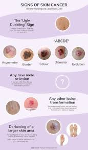 You keep getting a sore in the same place. Skin Cancer Signs Symptoms The Dermatologist S Essential Guide
