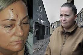 Woman glassed by nursery boss daughter at mother's funeral left 'physically  and emotionally scarred'