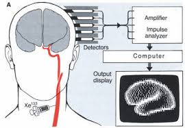 Image result for Higher Integrative Function