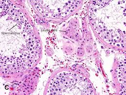 Testicular injury and spermatogenesis were assessed histopathologically using i am familiar with the miller and johnson methods for assesment of histology. Testis Seminiferous Tubules And Interstitium American Urological Association