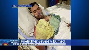 CO Firefighter Recovers from Severe Burns During House Blaze