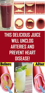 This Delicious Juice Will Unclog Arteries And Prevent Heart Disease Heart Disease Arteries Healthy Juices