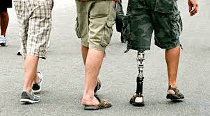 Apr 25, 2013 · the price of a new prosthetic leg can cost anywhere from $5,000 to $50,000. Robohand S Cheap 3d Printed Leg Is Set To Revolutionize Prosthetics Extremetech