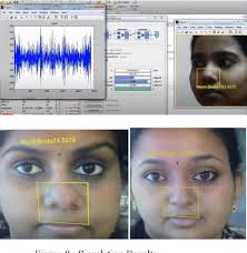 Real Time Heart Beat Monitoring Using Computer Vision