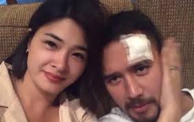 Jun 23, 2021 · kapamilya actress yam concepcion on wednesday, june 23, announced her engagement to her longtime boyfriend miguel cuunjieng. Jm De Guzman Suffers Damage Throughout Taping For New Present W Yam Concepcion Docuneedsph